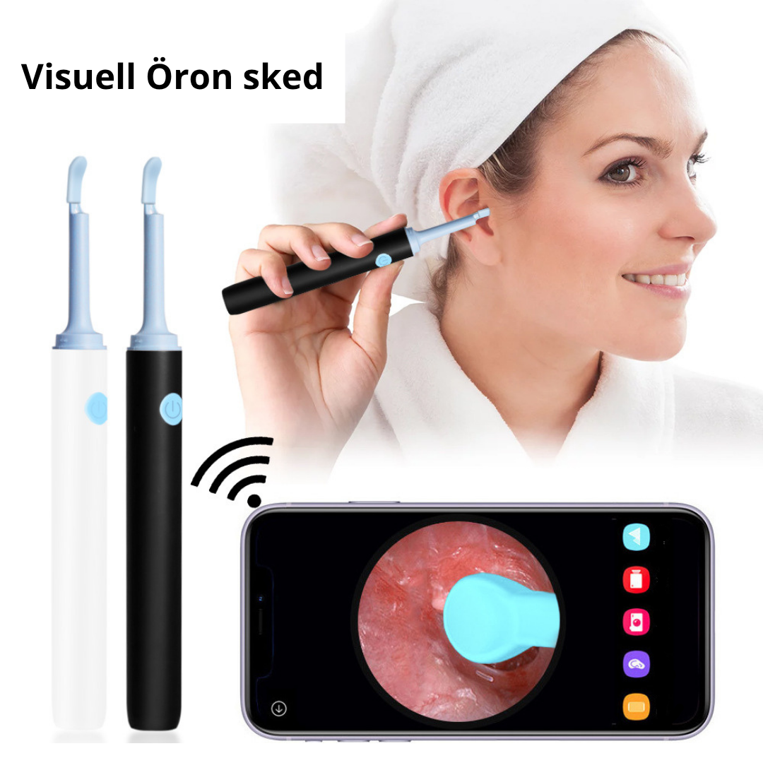 Smart Öronrengörare med Kamera — Se Vad Du Rengör!